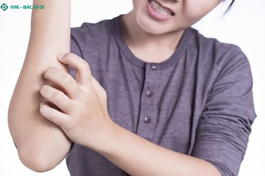 Nếu tình trạng mẩn đỏ ngứa không thuyên giảm, hãy đến bệnh viện thăm khám