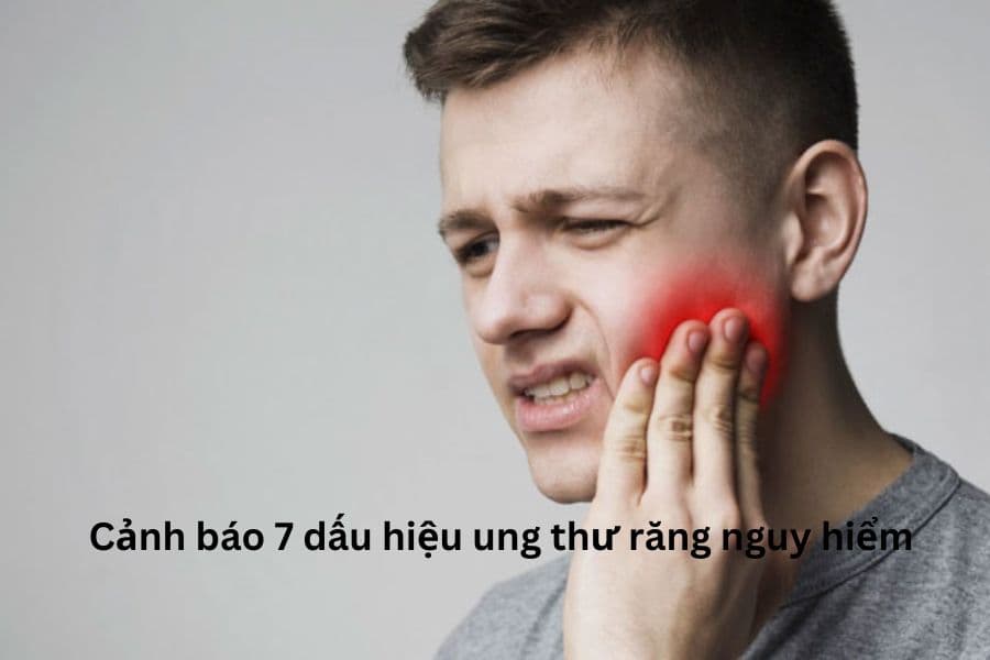 Cảnh báo 7 dấu hiệu ung thư răng nguy hiểm 
