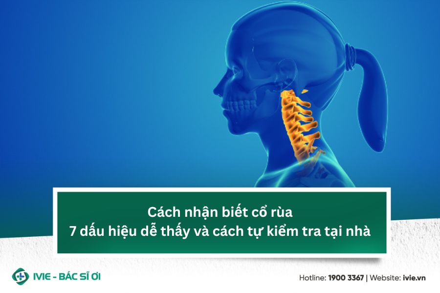 Cách nhận biết cổ rùa: 7 dấu hiệu dễ thấy và cách tự kiểm...