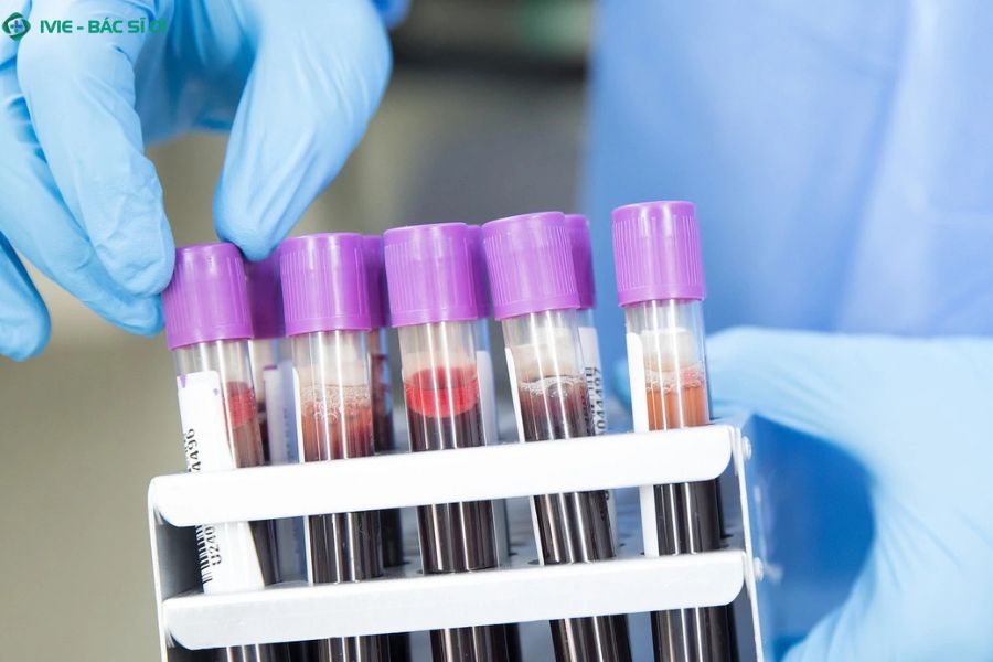 Tìm hiểu xét nghiệm ký sinh trùng giúp phát hiện sớm và điều trị kịp thời