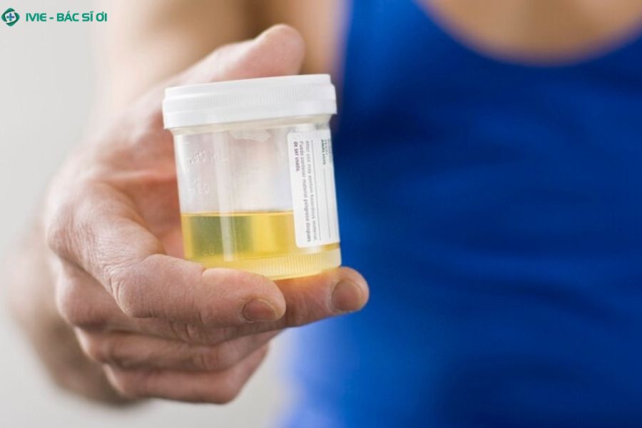 Nước tiểu bình thường có màu vàng nhạt