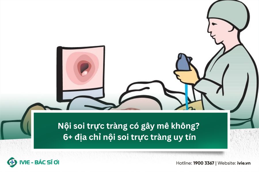 Nội soi trực tràng có gây mê không? 6 địa chỉ nội soi trực...