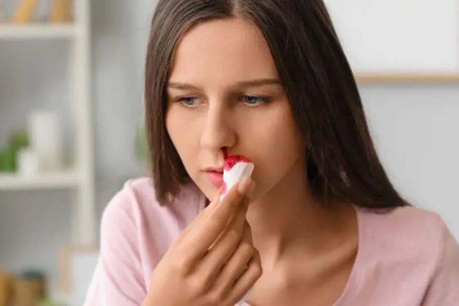 Mũi bị tổn thương gây chảy máu cam