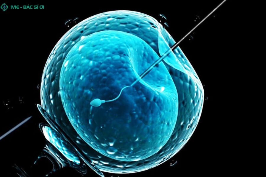 Phương pháp IVF trong hỗ trợ sinh sản