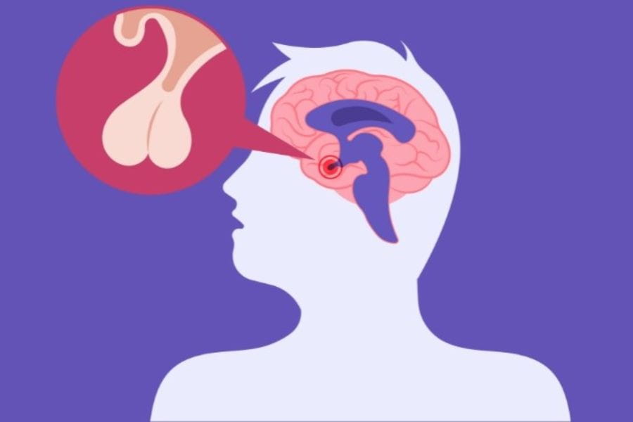 Ung thư tuyến yên và những điều bạn cần biết