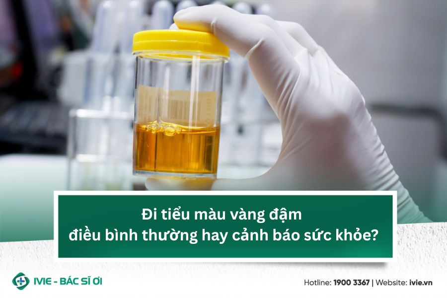 Đi tiểu màu vàng đậm điều bình thường hay cảnh báo sức khỏe?