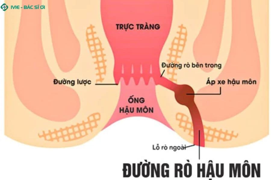 Đường lược phân chia vùng có cảm giác đau và vùng câm cảm giác trong ống hậu môn