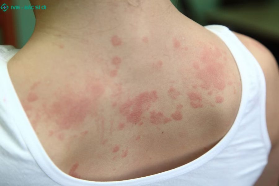 Tình trạng rối loạn da ở cả người lớn và trẻ em