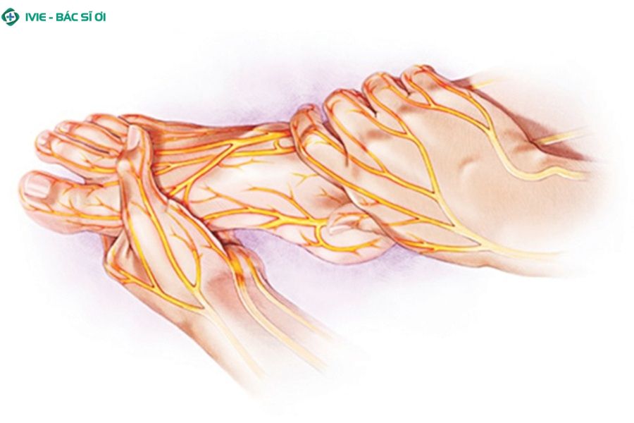 Nguyên nhân phổ biến gây đau nhức 10 đầu ngón chân