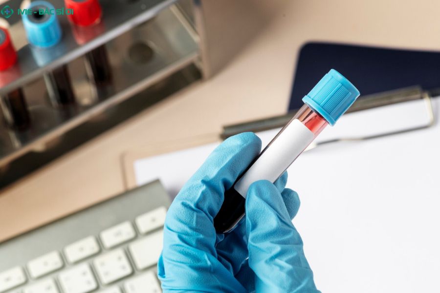 Các phương pháp xét nghiệm HIV hiện nay