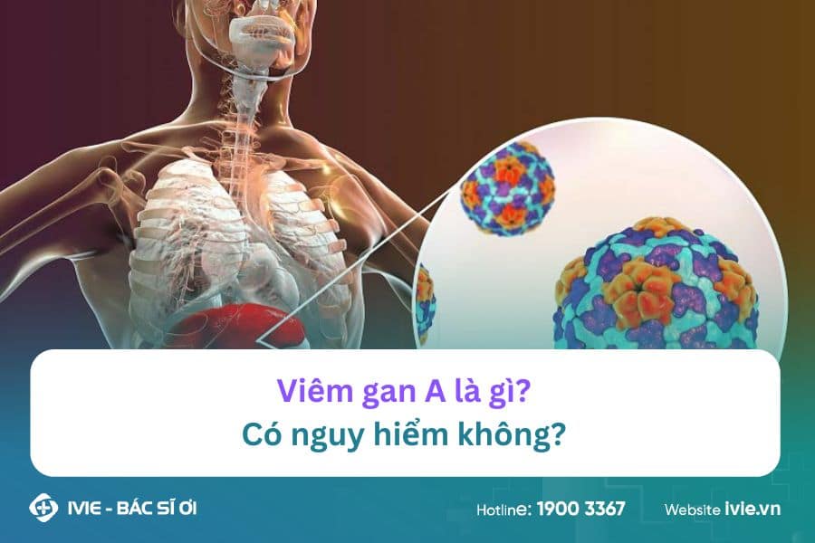Viêm gan A là gì? Có nguy hiểm không? 