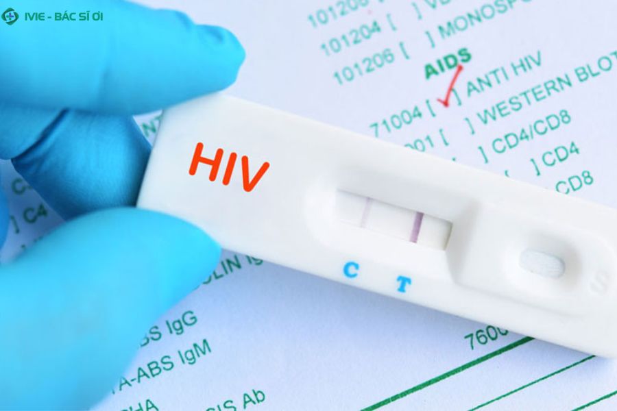 Khi nào nên xét nghiệm HIV để an tâm