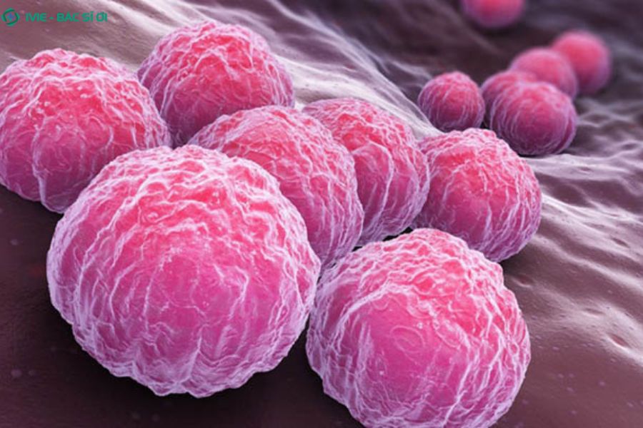 Viêm khớp phản ứng sau nhiễm khuẩn có thể gây rối loạn tiểu tiện và tiểu đêm nhiều lần