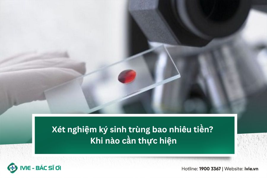 Xét nghiệm ký sinh trùng bao nhiêu tiền? Khi nào cần thực...