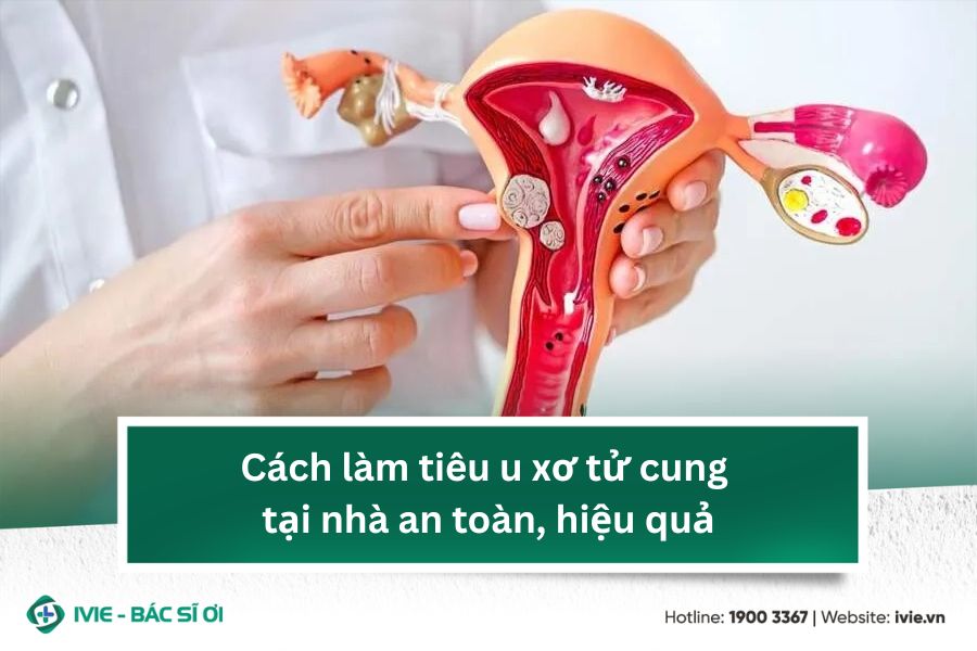 Cách làm tiêu u xơ tử cung tại nhà an toàn, hiệu quả