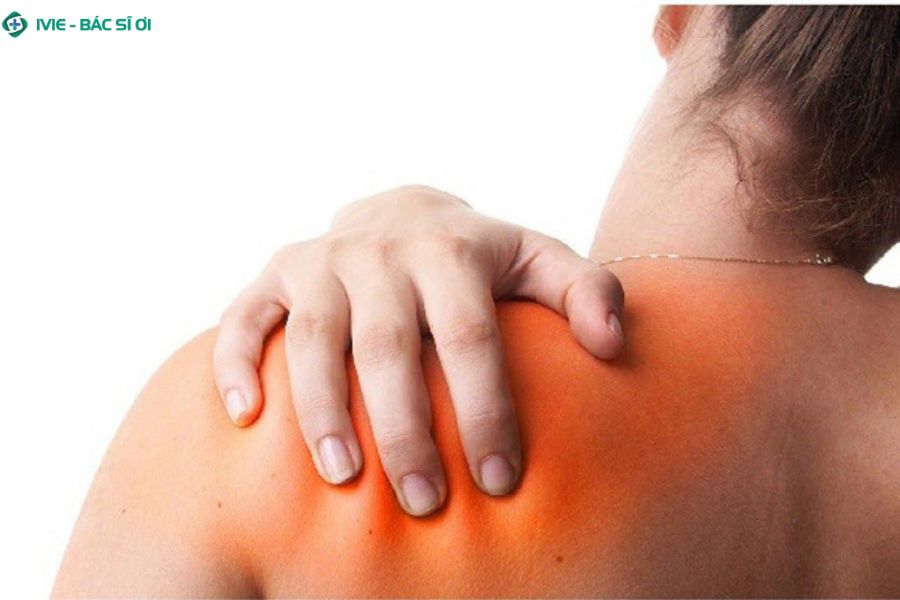 Căng cơ vùng cổ vai gáy nguyên nhân phổ biến gây đau và cứng cổ bên trái