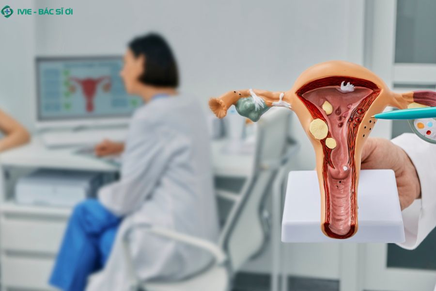 Lạc nội mạc tử cung thường khó chữa dứt điểm hoàn toàn