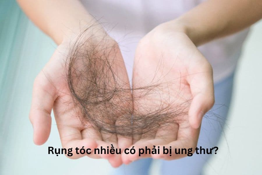 Rụng tóc nhiều có phải bị ung thư?