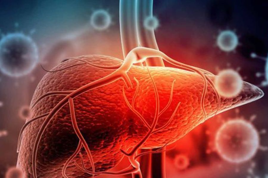 5+ Thực phẩm người bị viêm gan B cần kiêng để nhanh khỏi