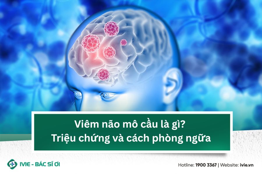 Viêm não mô cầu là gì? Triệu chứng và cách phòng ngữa