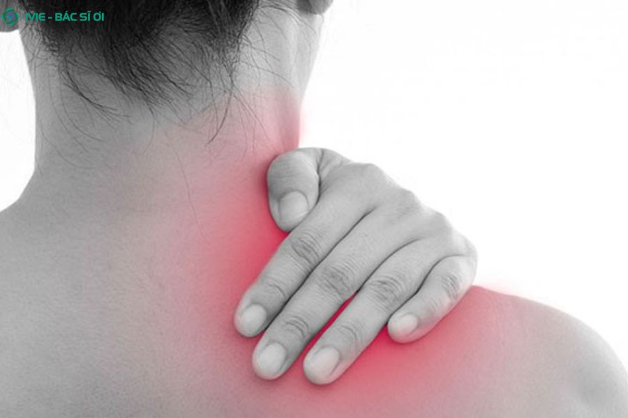 Đau cổ vai gáy bên phải khiến cổ và vai bạn bị nhức mỏi, cứng và khó cử động