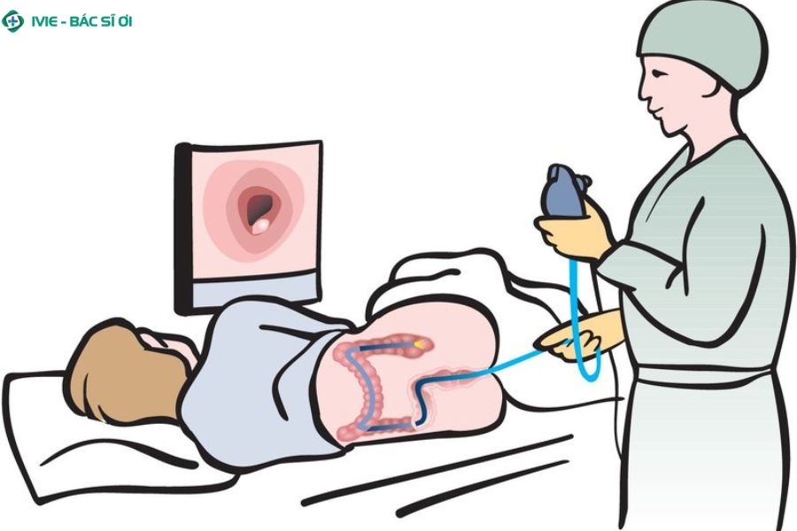 4 lưu ý quan trọng giúp nội soi đại tràng an toàn, hiệu quả và không lo biến chứng