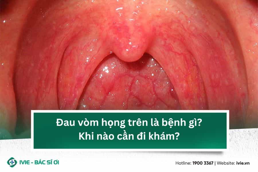 Đau vòm họng trên là bệnh gì? Khi nào cần đi khám?