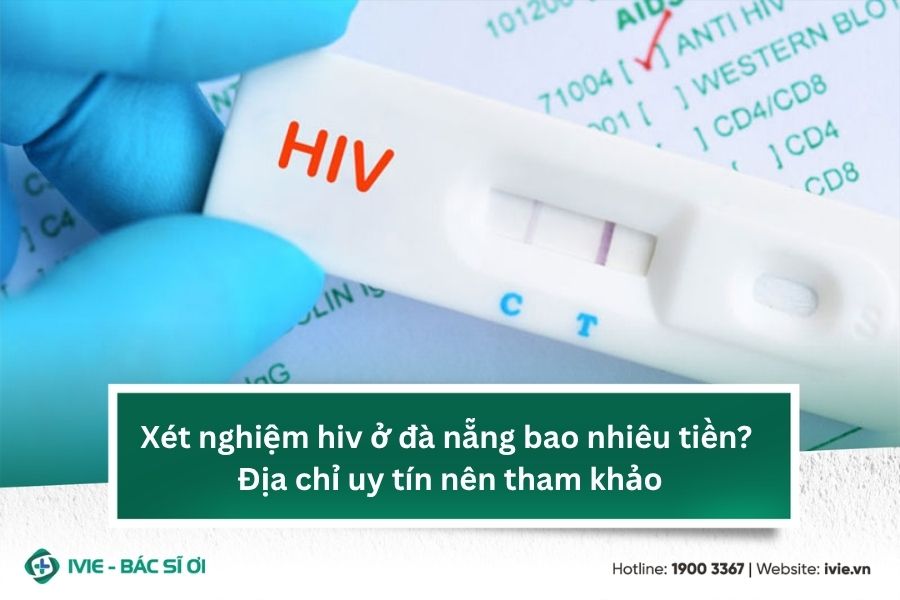 Xét nghiệm hiv ở đà nẵng bao nhiêu tiền? Địa chỉ uy tín nên ...