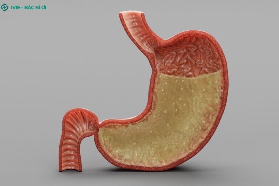 Chất nhầy trong dịch vị lớp áo giáp bảo vệ niêm mạc dạ dày khỏi acid và enzyme tiêu hóa