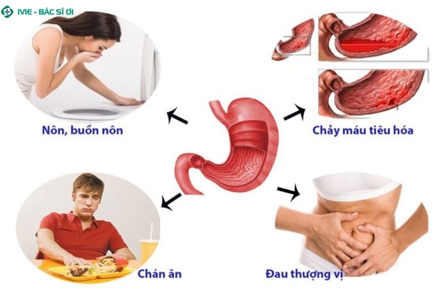 Việc nhận biết sớm triệu chứng xuất huyết dạ dày giúp can thiệp kịp thời, tránh biến chứng nặng