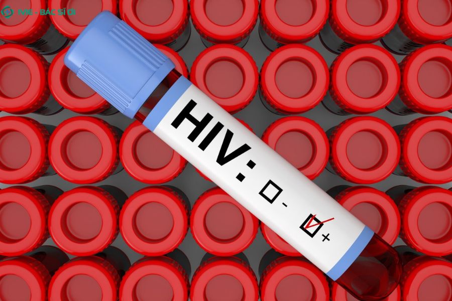 Sau 45 ngày xét nghiệm HIV đã chính xác chưa?