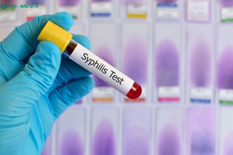 Việc thực hiện xét nghiệm bệnh tình dục định kỳ là cách tốt nhất để tầm soát các bệnh lý tiềm ẩn ngay cả khi cơ thể chưa xuất hiện triệu chứng