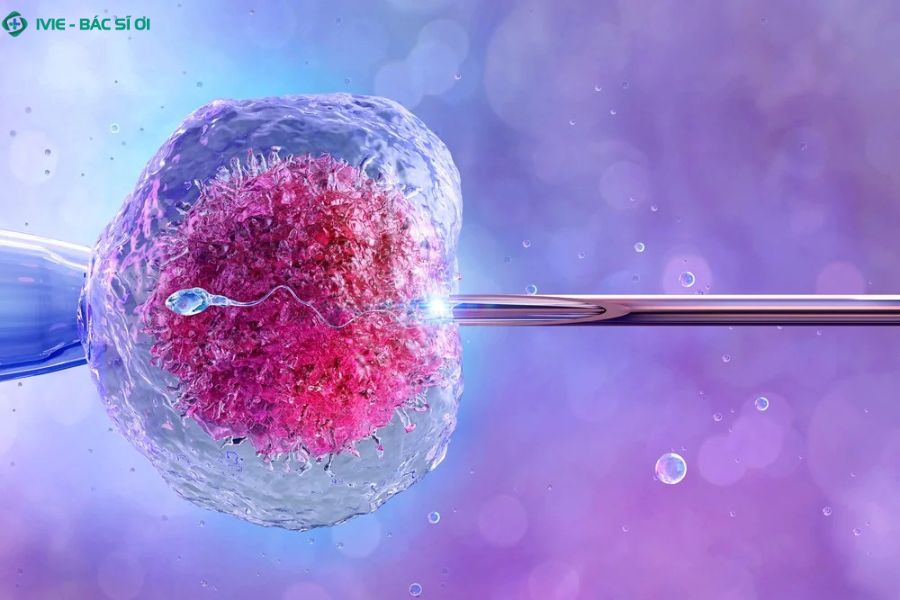 IVF là phương pháp thụ tinh trong ống nghiệm