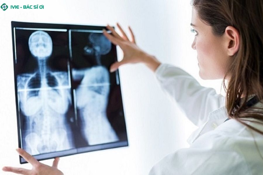 Khi nào cần chụp X-quang cơ xương khớp