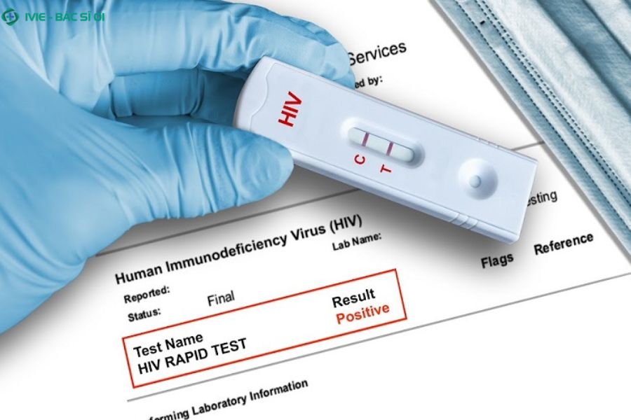 Cách hiểu kết quả xét nghiệm HIV