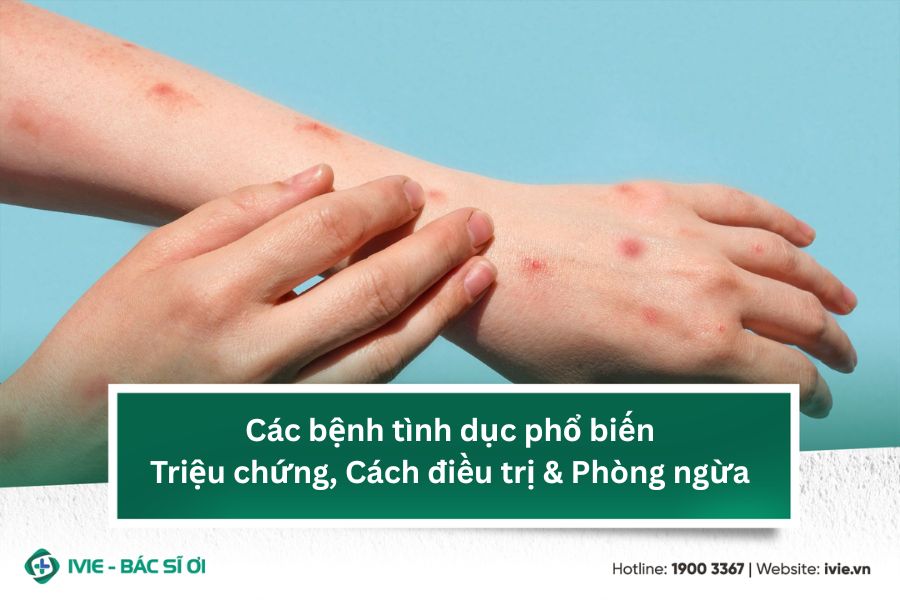 Các bệnh tình dục phổ biến: Triệu chứng, Cách điều trị &...