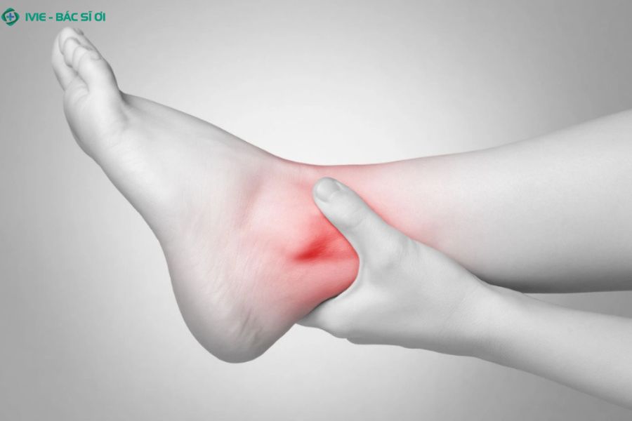 Dấu hiệu bong gân cần đi khám sớm