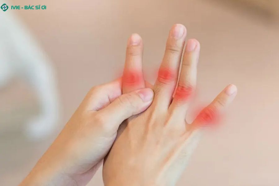 Các nguyên nhân thường gặp gây sưng đau ngón tay bao gồm viêm khớp, gout, chấn thương hoặc rối loạn nội tiết