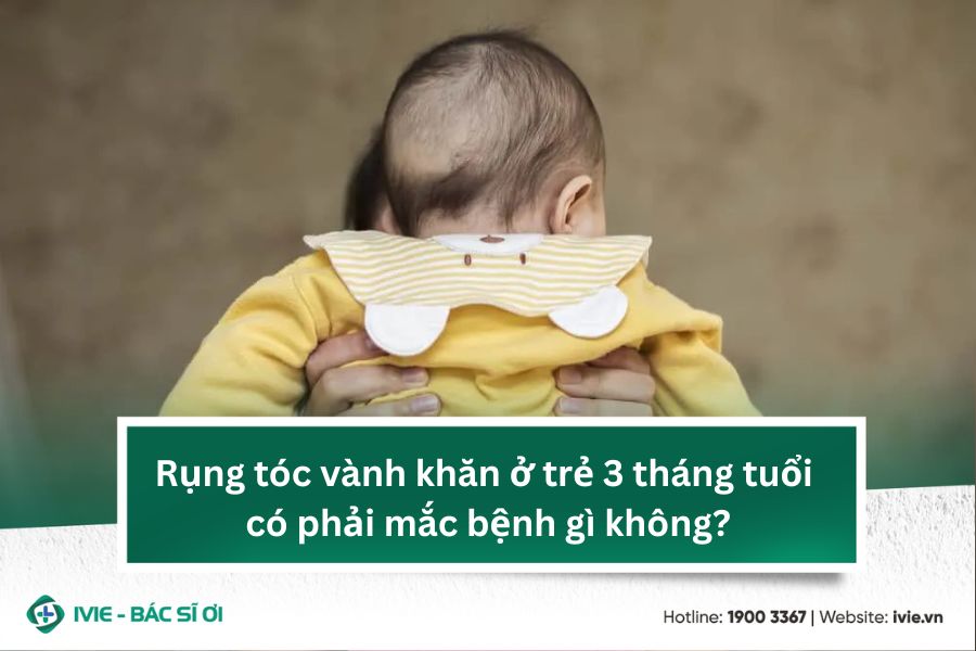Rụng tóc vành khăn ở trẻ 3 tháng tuổi có phải mắc bệnh gì...