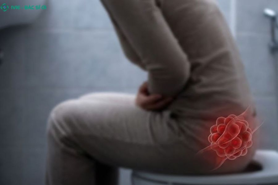 Các hình thái đi ngoài ra máu tươi và máu đỏ sẫm phản ánh vị trí tổn thương khác nhau trong ống tiêu hóa
