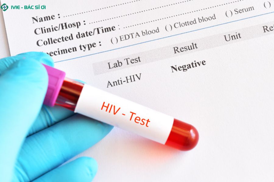 Xét nghiệm HIV bao lâu có kết quả?