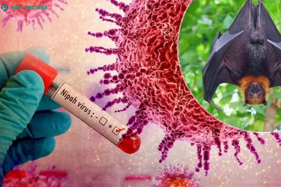 Tìm hiểu về virus Nipah