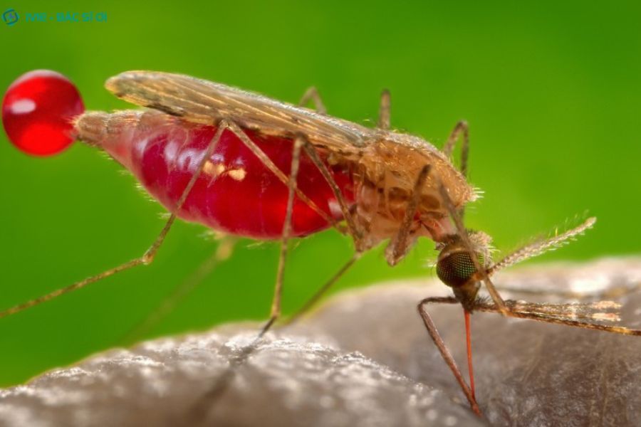 Biểu hiện của sốt rét ác tính thể não