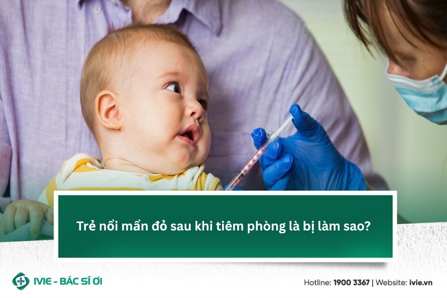 Trẻ nổi mẩn đỏ sau khi tiêm phòng là bị làm sao?