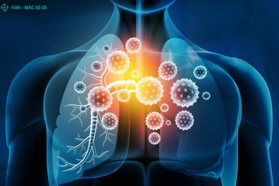 Dấu hiệu nhiễm trùng đường hô hấp và phương pháp chẩn đoán