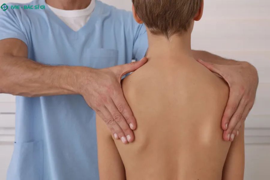 Dấu hiệu điển hình của gù cột sống Scheuermann là đốt sống phát triển bất thường