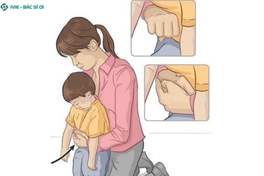 Thực hiện thủ thuật Heimlich đúng cách để sơ cứu hóc dị vật ở trẻ trên 1 tuổi