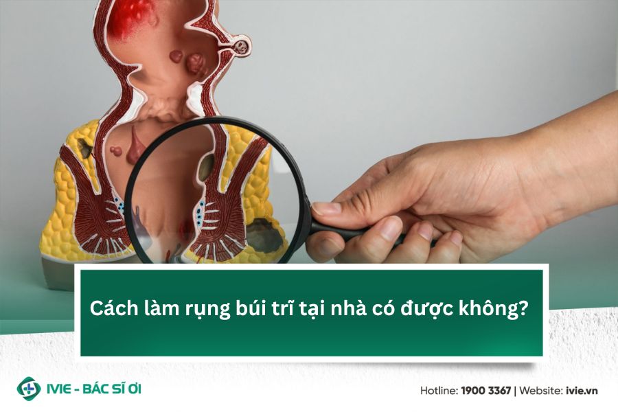 Cách làm rụng búi trĩ tại nhà có được không?
