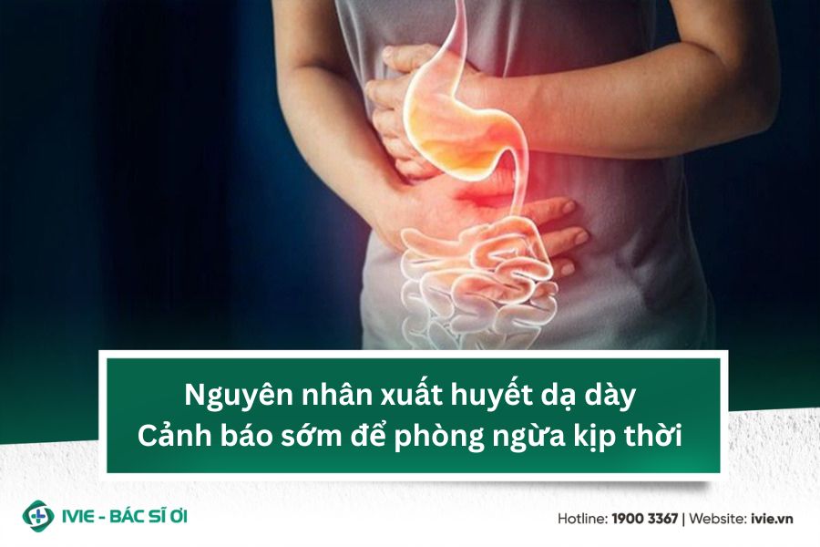 Nguyên nhân xuất huyết dạ dày: Cảnh báo sớm để phòng ngừa...