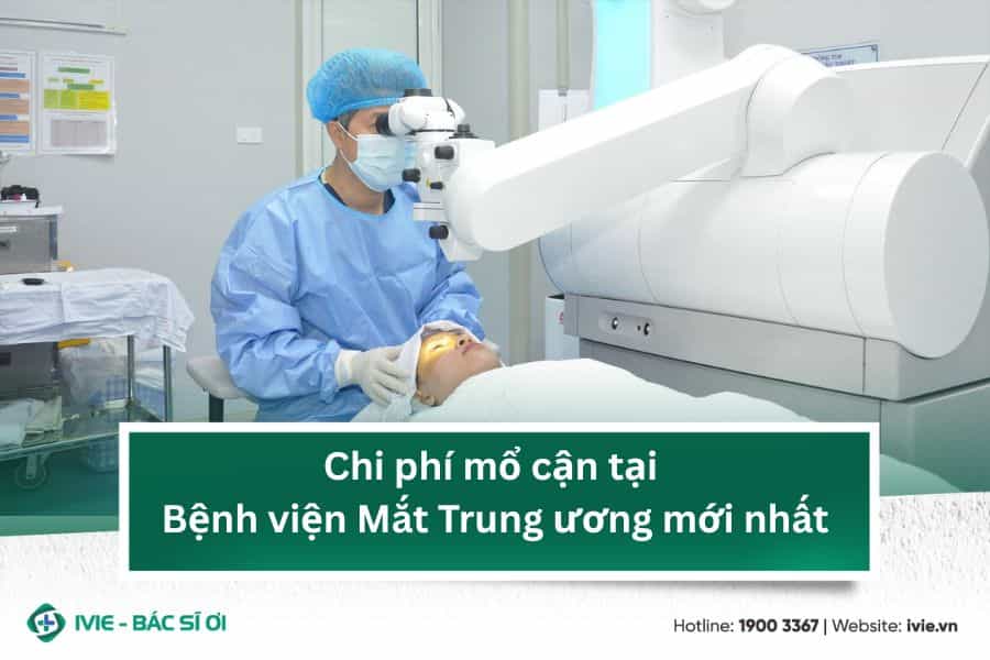 Chi phí mổ cận tại Bệnh viện Mắt Trung ương mới nhất